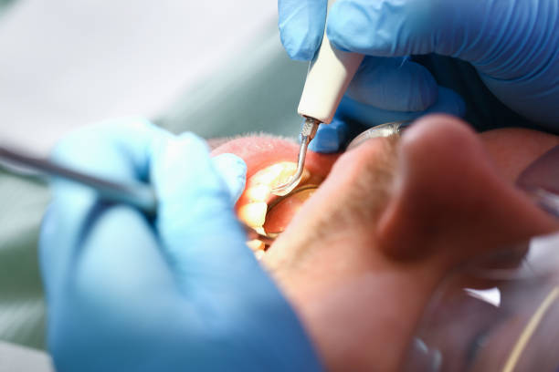 Best Pediatric Emergency Dentist in Flower Hill, NY